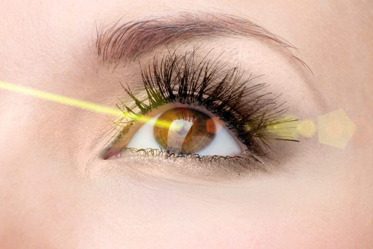 Laser vision correction. Woman's  eye.